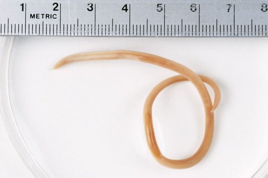 Ascaris je okrugli crv koji živi u ljudskom tijelu
